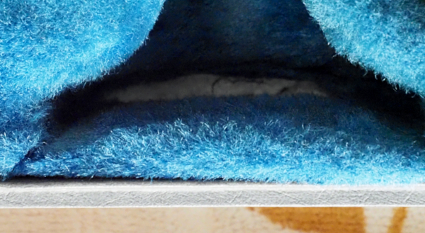 Side Front of the Case (Before treatment)